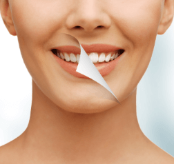 SW Calgary Teeth Whitening | Wentworth Family Dental | General & Family Dentist | SW Calgary