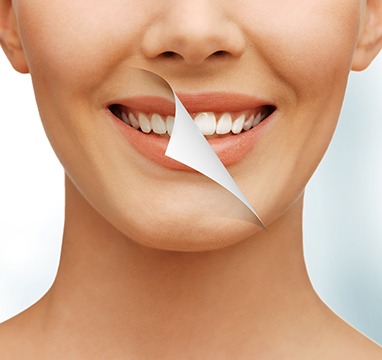 SW Calgary Teeth Whitening | Wentworth Family Dental | General & Family Dentist | SW Calgary