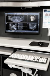X-Rays | Wentworth Family Dental | General & Family Dentist | SW Calgary